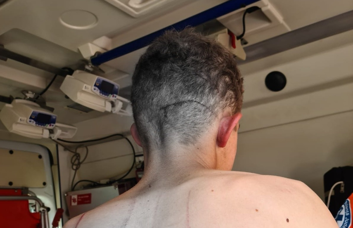 FOTO Un tânăr de 19 ani a fost atacat de un urs, în Harghita. Cum a reușit să scape cu viață