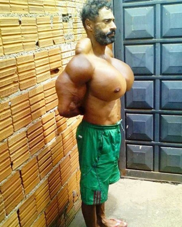 „Hulk al Braziliei” a murit la 55 de ani, după ce și-a injectat ulei în mușchi. GALERIE FOTO