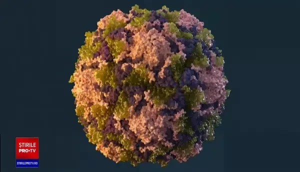 Ce este poliomielita și cum se manifestă. Dacă nu aveţi acces la apă curată, să o fierbeţi înainte să o beţi