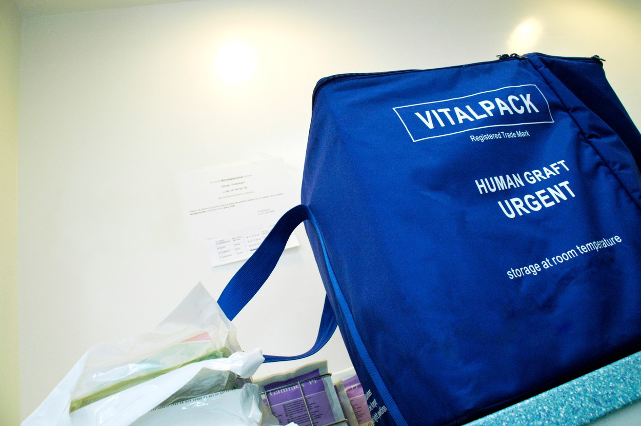 O clinică medicală din București este cercetată penal pentru că a introdus în ţară organe umane fără a avea autorizaţie