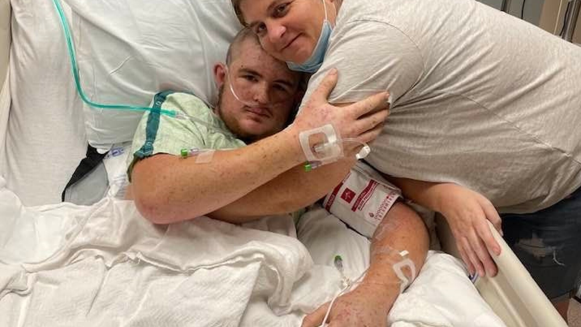 Cum arată un tânăr după ce a fost înțepat de peste 20.000 de ori de albine ucigașe, în timp ce curăța un copac. FOTO