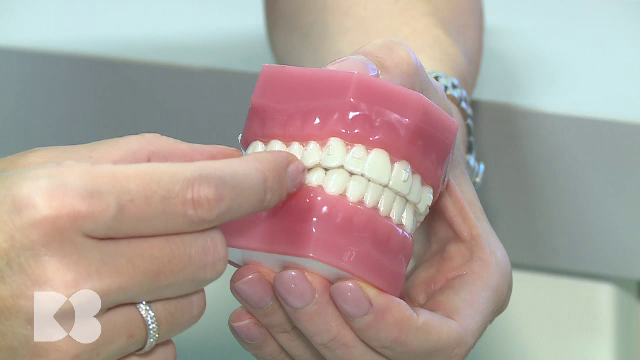 Adulții de peste 30 ani își pierd cel puțin un molar de șase ani. Ce este indicat să faceți pentru copilul dumneavoastră