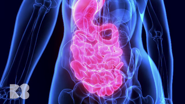 Anemia prin deficit de fier nu se tratează prin fier. Care este soluția pentru cea mai frecventă afecțiune din lume