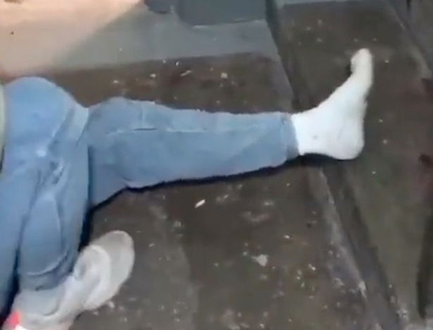 Disperarea tinerilor din Rusia atinge cote maxime. Un rus și-a rupt piciorul intenționat pentru a scăpa de recrutare | Video