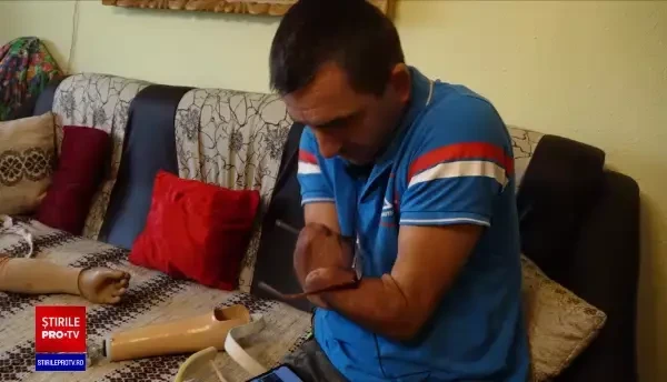 Un bărbat de 49 de ani a rămas fără mâni, după un accident teribil. Acum merge pe bicicletă, gătește și are o singură dorință