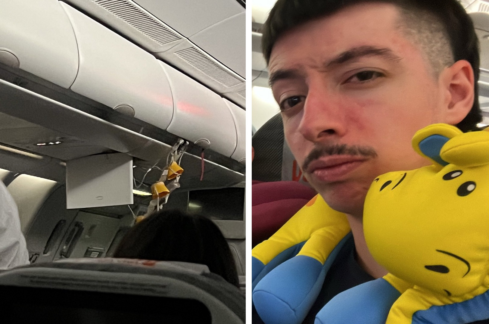 FOTO. Momente de groază în aer. 12 persoane au fost rănite în timpul zborului. „Este posibil să am fractură nazală”