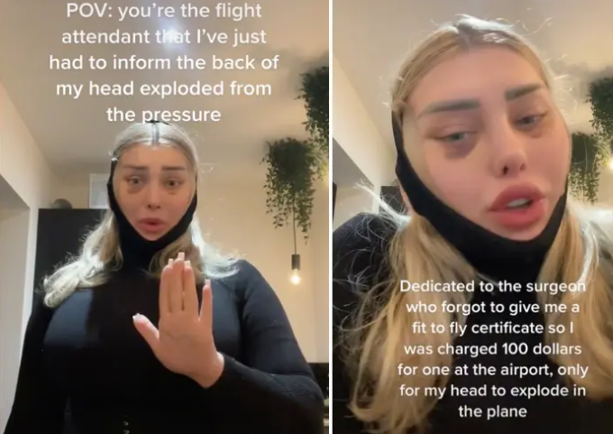 Ce a pățit o tânără care s-a urcat în avion imediat după o operație estetică. „Evident că era sânge”