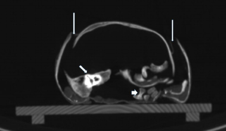 A fost descoperit misterul băiatului mumificat, la 400 de ani de la moartea lui. Cine era de fapt GALERIE FOTO