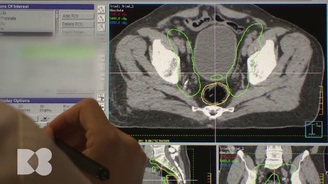 Semnalul de alarmă care arată că rinichii nu funcționează bine. Ce trebuie să facem în fiecare an