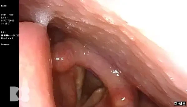 Vitamina C este esențială pentru organism în combinație cu Zinc și Seleniu. Cum le putem asimila