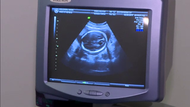 Condițiile pentru a beneficia de ajutorul de la stat pentru fertilizare in vitro. Ce trebuie să conțină dosarul