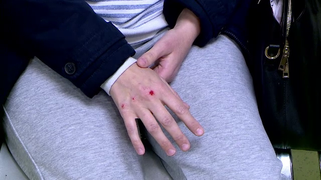 Zeci de oameni au ajuns la spital după ce au alunecat pe gheață. Șoferii aruncă singuri cu nisip pentru a putea circula