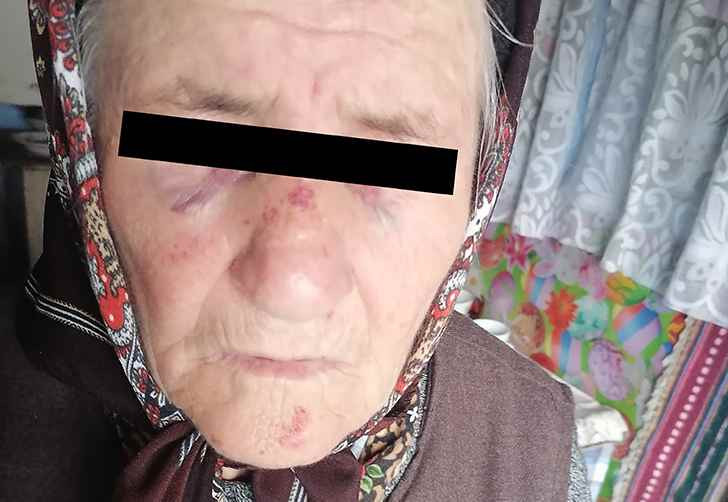 Bunicuță din Vaslui, snopită în bătaie pentru un pumn de tămâie. Agresorul credea că „umblă cu vrăji"