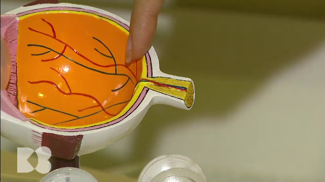 Cum sunt afectați ochii de diabet. Medicii recomandă un control pe an la oftalmolog