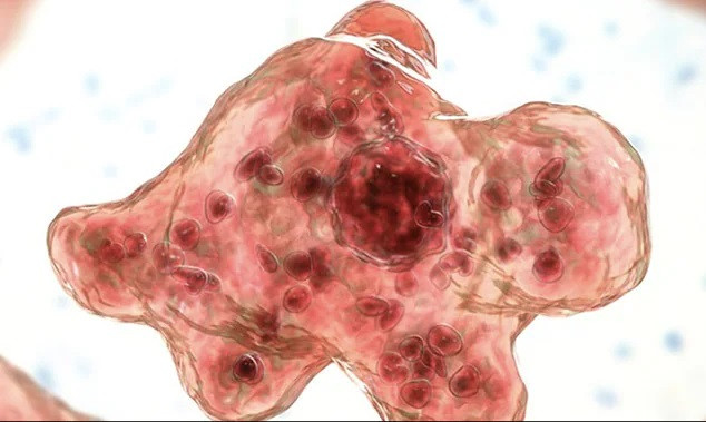 Încă o țară anunță primul deces provocat de amiba „devoratoare de creier”. Ce a pățit un bărbat când s-a întors din vacanță