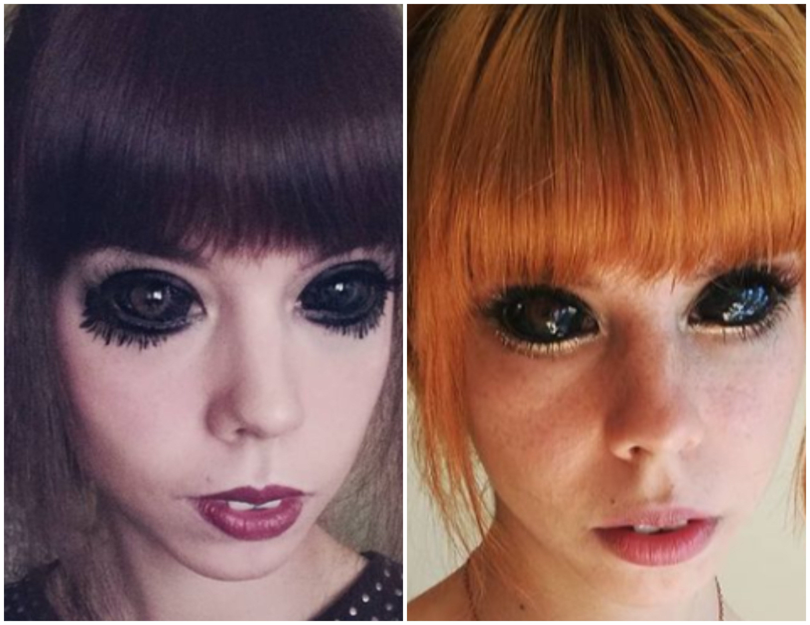 Mutilată pe viață. În ce stare se află acum o tânără de 25 de ani, care a vrut să-și tatueze albul ochilor