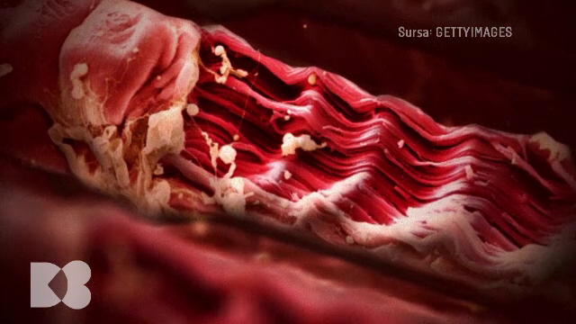 Ce proprietăți are colesterolul bun, numit HDL colesterol și cât de importantă este mișcarea în menținerea nivelului optim