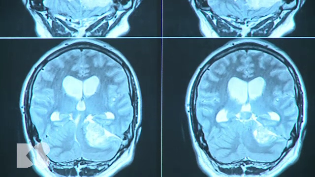 Expunerea la informații vizuale crește capacitatea cognitivă și pornește mai devreme pubertatea. Explicațiile specialiștilor