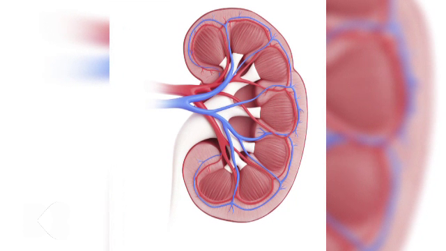 O persoană din 10 va ajunge la boală cronică de rinichi la nivel mondial. De ce diagnosticul apare târziu și ce se întâmplă