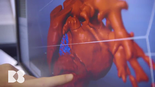 Cum apare infarctul de miocard sau accidentul vascular cerebral. Cauzele acestora, explicate de medici specialiști