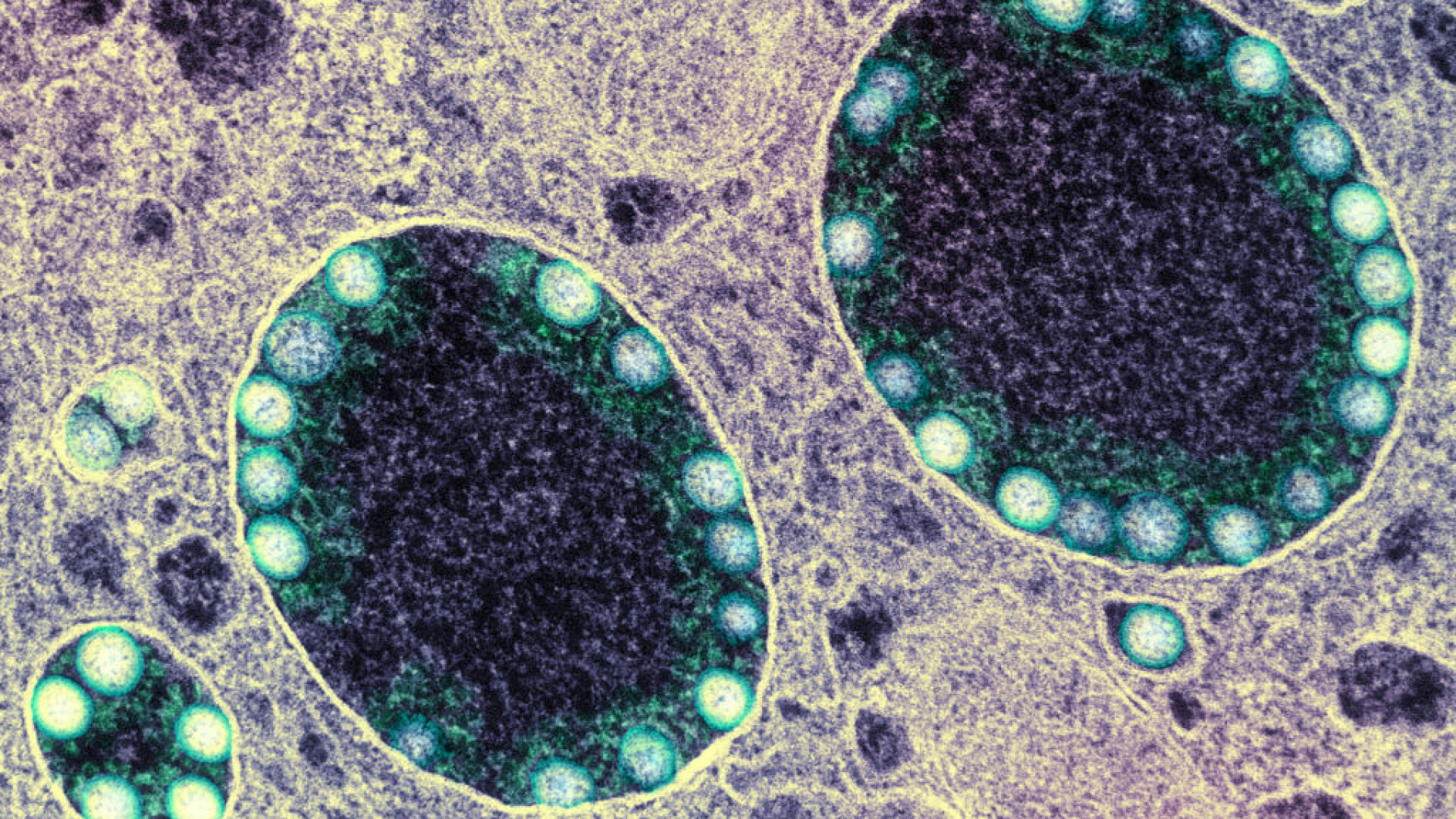 Reacția Chinei după ce șeful FBI a afirmat că originea Covid-19 este „foarte probabil” un accident la un laborator din Wuhan