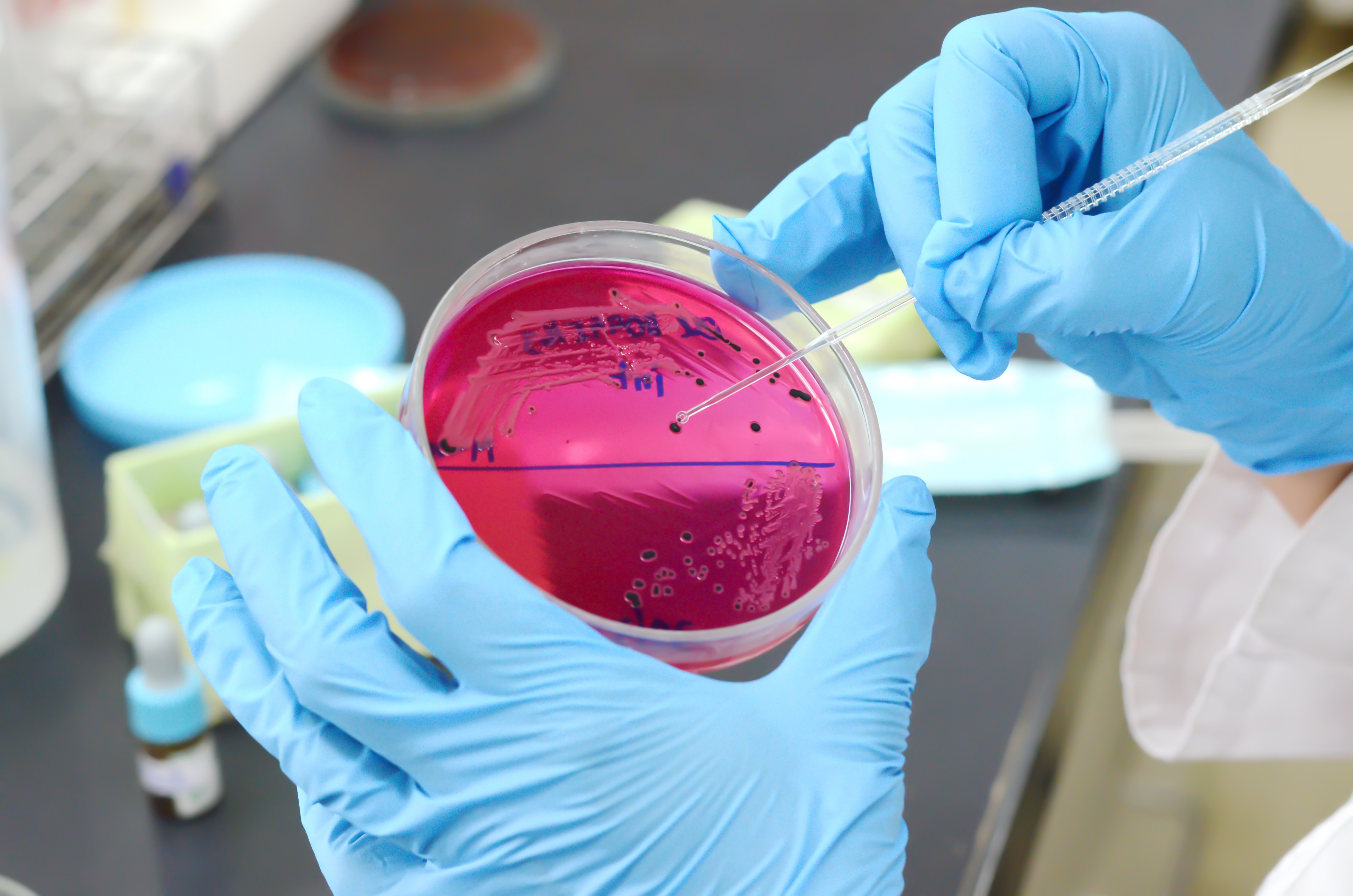 Salmonella și Campylobacter nu mai răspund la antibiotic. Avertismentul oamenilor de știință