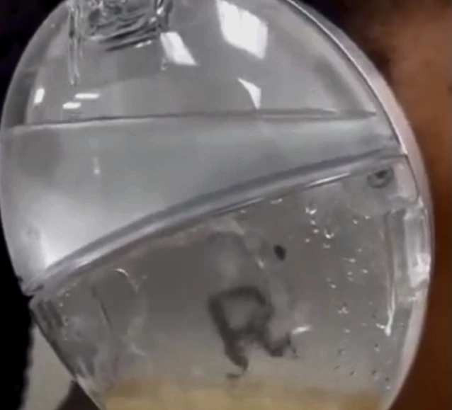 Căștile care curăță ceara din urechi, autorizate în SUA. Cum funcționează și care este rezultatul