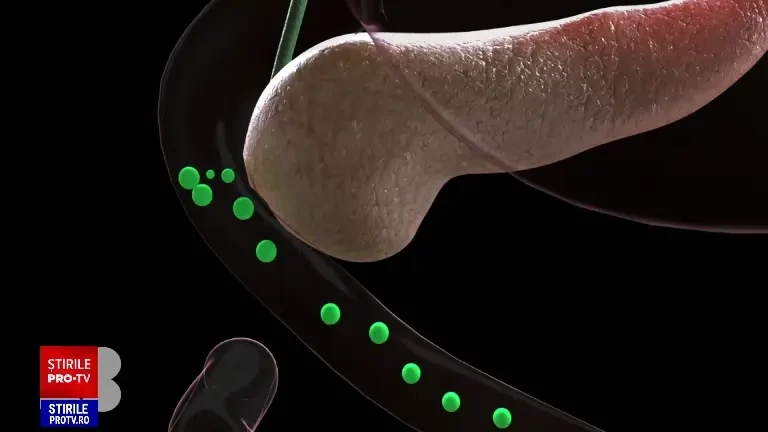 Ce se întâmplă cu pancreasul atunci când mâncăm prea multă mâncare. Explicațiile medicilor specialiști