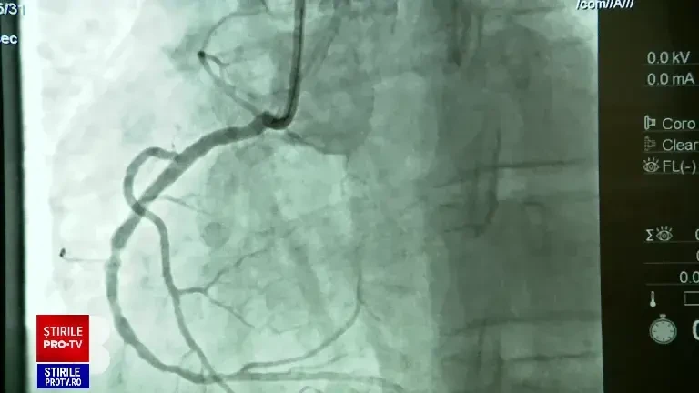 România este în prima clasă de risc în privința aterosclerozei. Ce este această boală și ce riscuri aduce cu sine