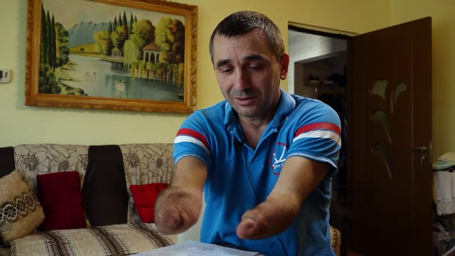Mobilizare pentru Florin, băimăreanul rămas fără mâini după un accident de muncă. ”Îmi doresc să-mi strâng băiatul în brațe”