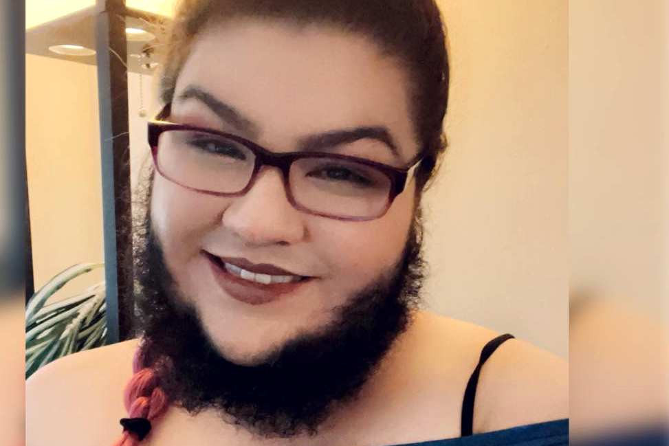 Femeia cu barbă a renunțat la aparatul de ras. „Partenerului meu îi place să își treacă degetele prin ea” | VIDEO