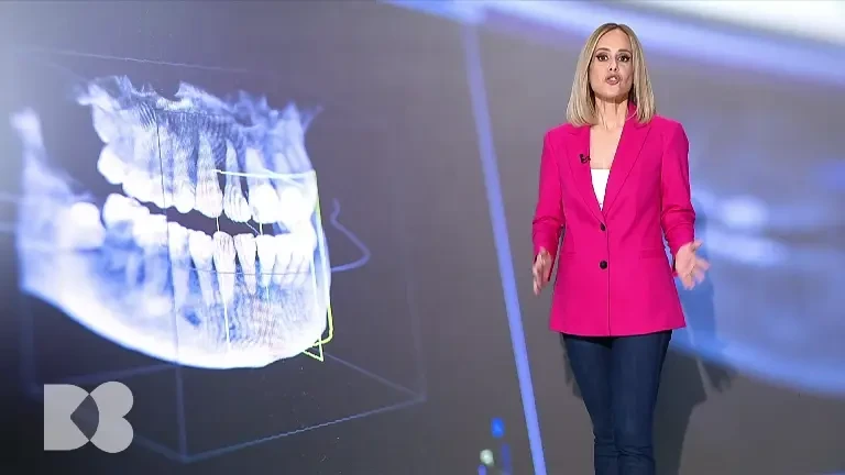 Stomatologia într-o singură etapă reabilitează complet problemele dinților și a oaselor maxilare. Ce spun medicii stomatologi