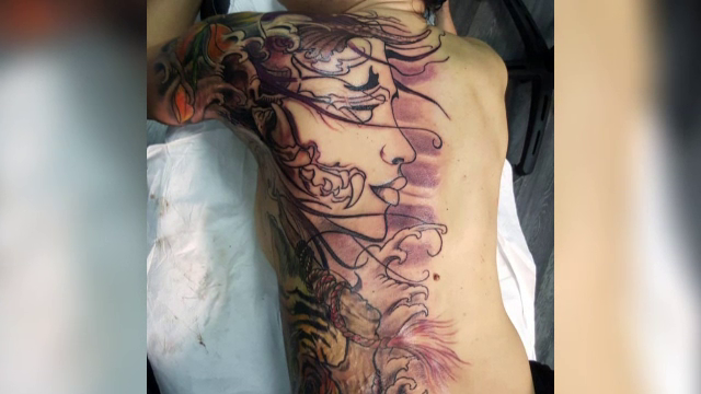 Tatuajele medicale încep să acopere traume și în România. În Austria sunt decontate de stat
