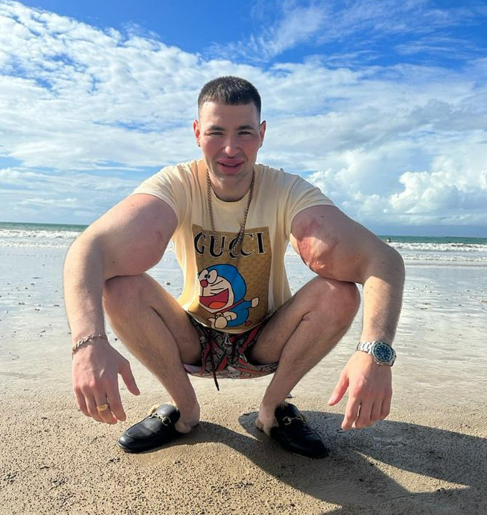 Popeye Marinarul din Rusia. Cum arată bărbatul care și-a injectat ulei în bicepși și arată ca celebrul personaj animat | FOTO