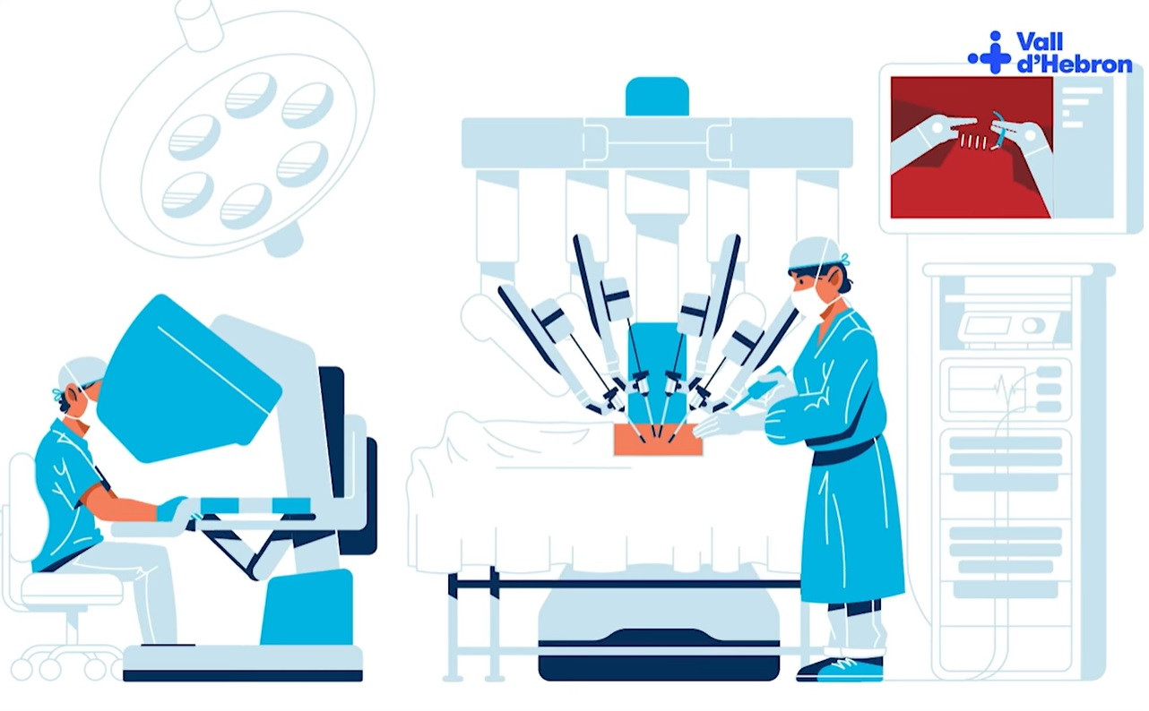 Transplant pulmonar realizat în Spania cu ajutorul unui robot