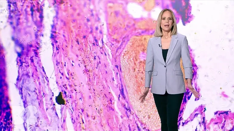 De câte ori este recomandat să mergeți la dermatolog în cazul leziunilor apărute pe piele. Pot duce la apariția cancerului