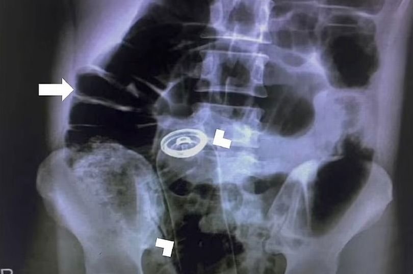 radiografie