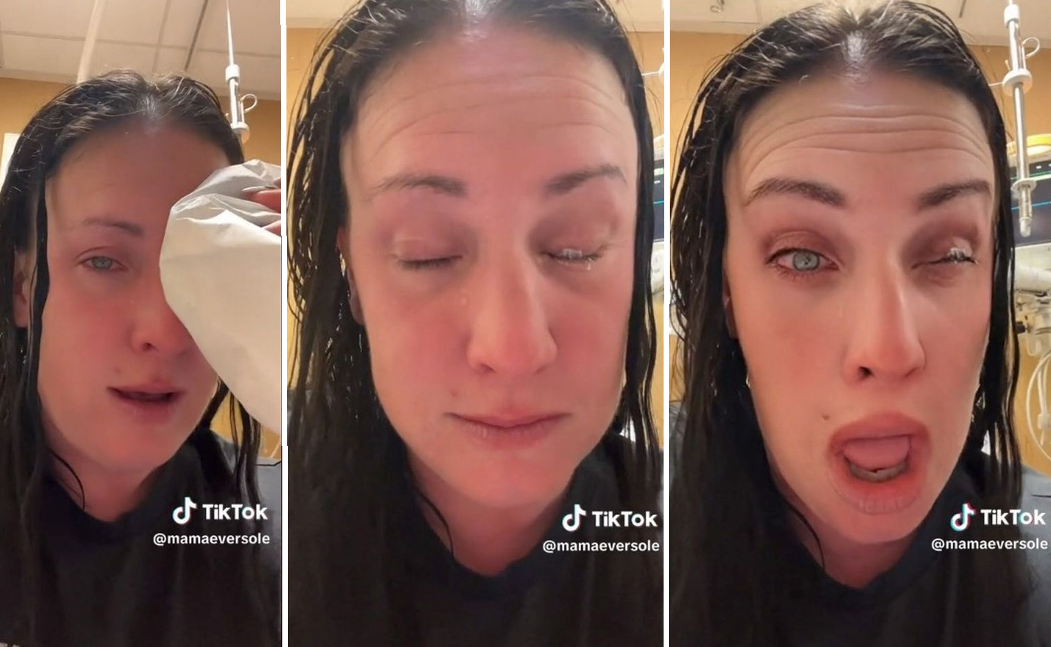 Pățania unei femei care a încurcat picăturile pentru ochi cu sticla cu lipici. VIDEO