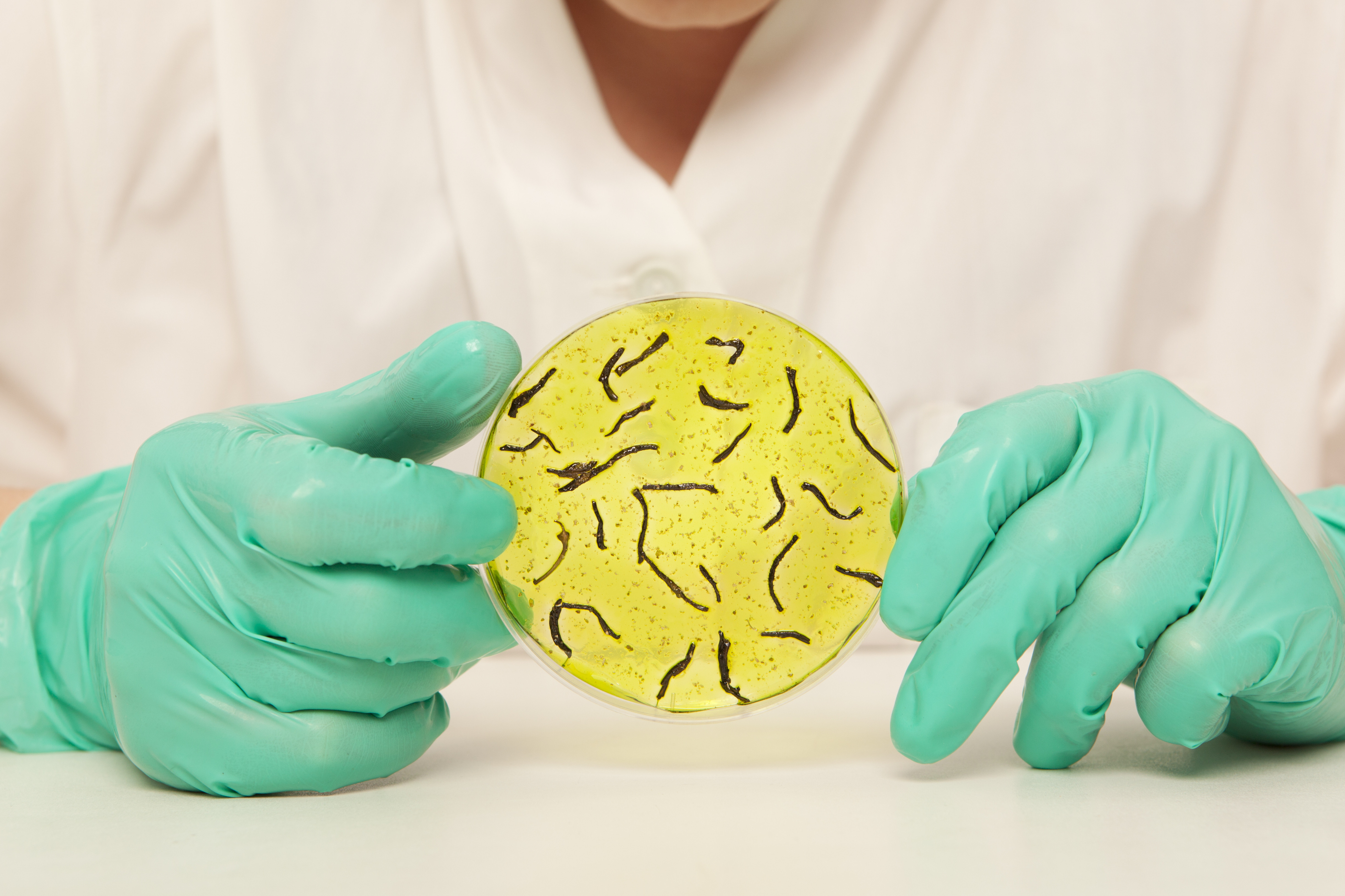 OMS: Peste 300 de decese raportate în Etiopia, în urrma foacrului de holeră