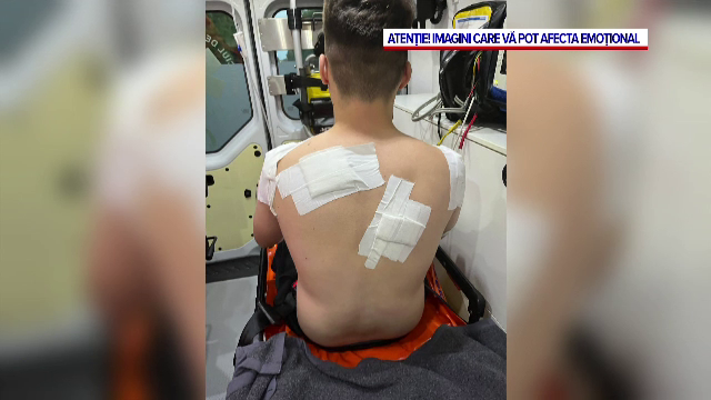 Adolescenți atacați, din senin, pe o stradă din Turnu Mărgurele. Momentul în care unul dintre ei a fost înjunghiat în spate