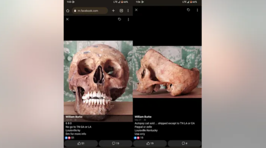 craniu