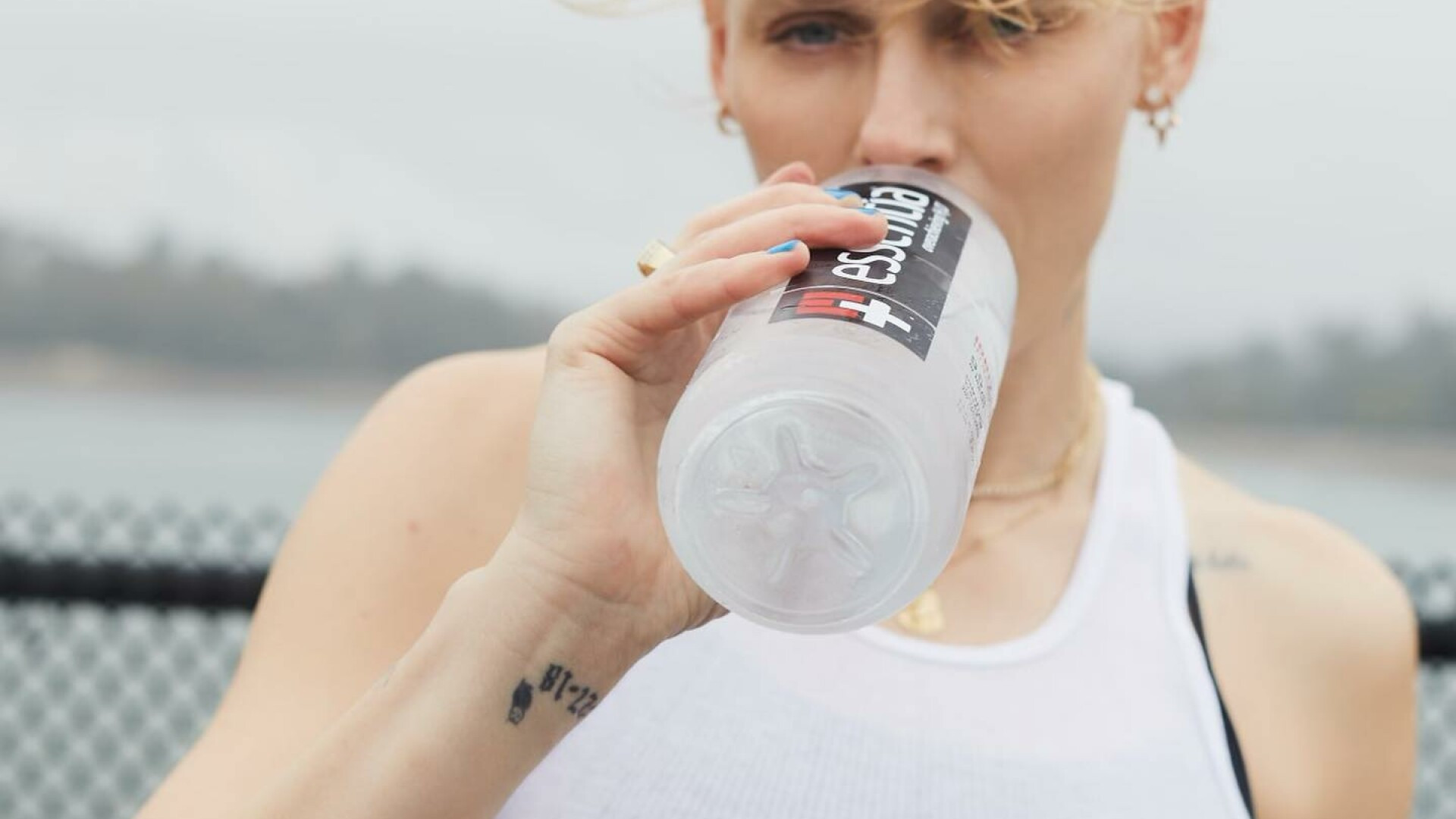 Cum arată modelul care și-a pierdut ambele picioare din cauza unui tampon. „Picioarele mele erau în flăcări” | GALERIE FOTO