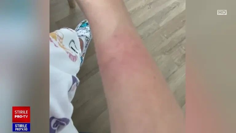 Cum combatem infestarea cu ploșnițe. Mai multe zone din țară sunt afectate de răspândirea insectelor