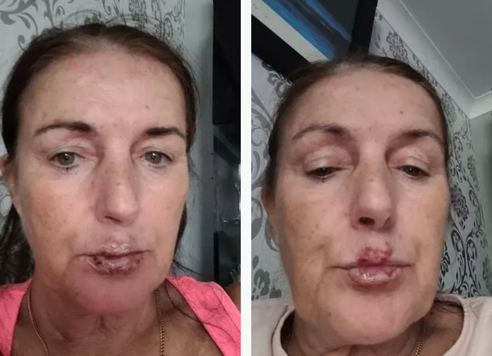 „A fost un coșmar”. Ce a pățit o femeie de 58 de ani în timpul unei vacanțe petrecute la un hotel din Republica Dominicană