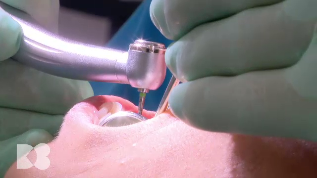 Nu doar igiena precară sau traumatismele pot duce la pierderea dinților. Printre cauze se numără și diabetul