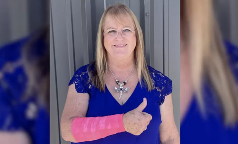 O femeie a fost rănită după ce un şoim a scăpat un şarpe pe ea și ambele au atacat-o. „Șarpele îmi ataca fața”