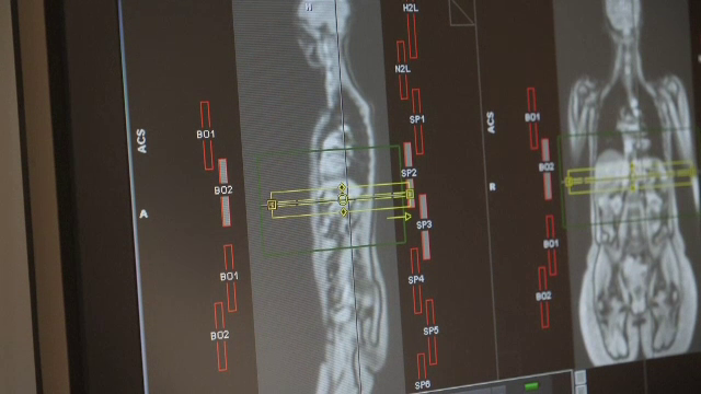Semnele care arată că ai putea face diabet în următorii 10 ani. Un român din cinci este în această situație
