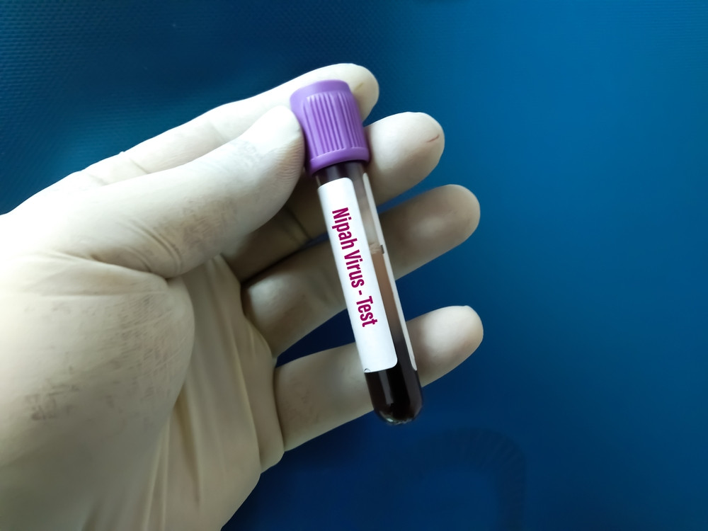 Cursă contracronometru pentru oprirea răspândirii unui virus letal, în India. Două persoane au murit deja de boală