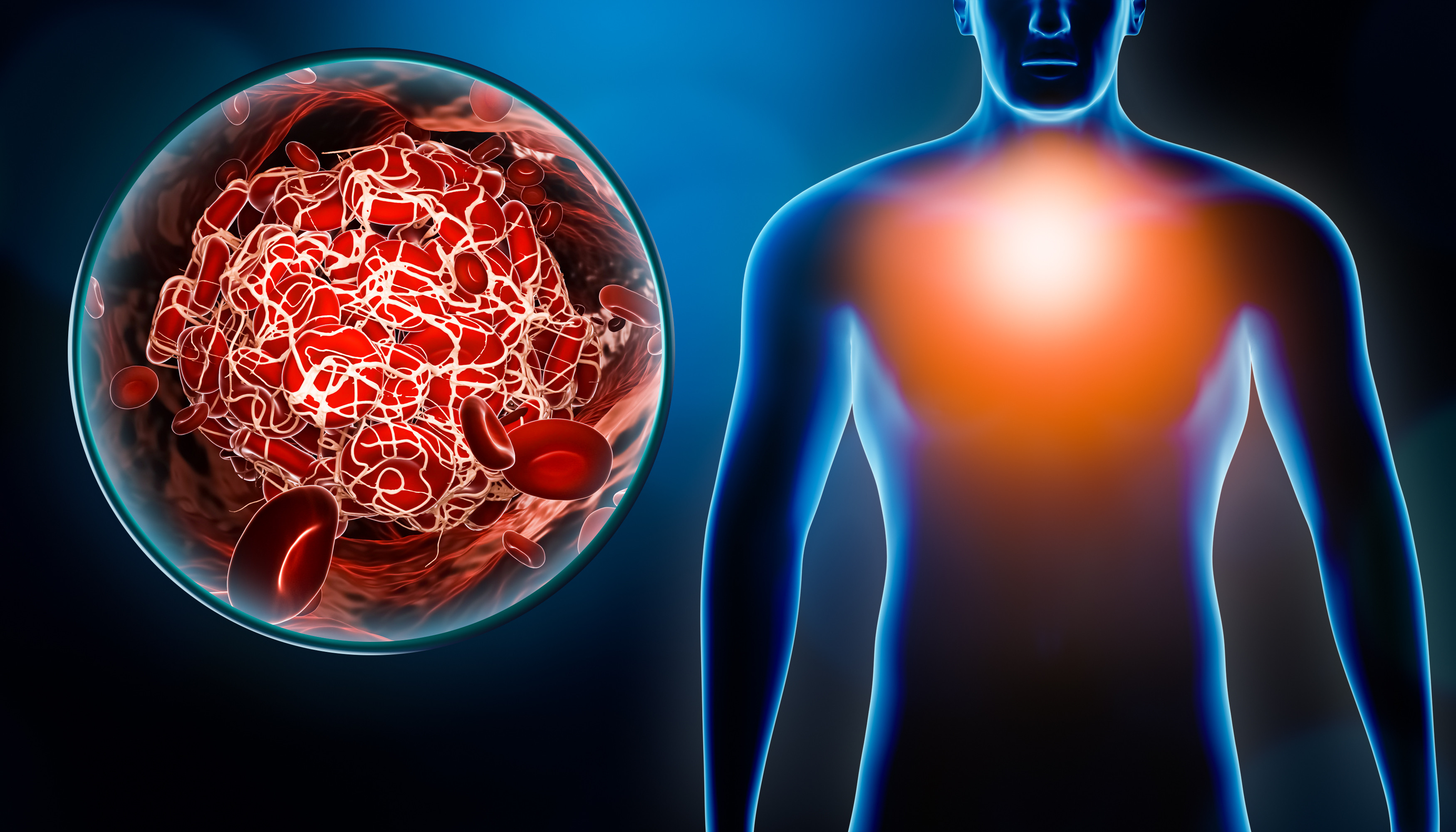 Explicația pentru care apar accidentele vasculare. Cum pot fi prevenite