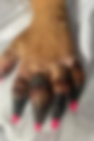 A crezut că are o boală de stomac, dar a stat trei zile în comă. Și-a pierdut un picior, iar acum urmează să îi cadă degetele